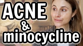 Minocycline versus doxycycline for acne Dr Dray [upl. by Carlo207]