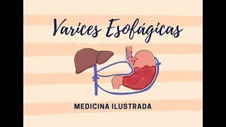 Varices Esofágicas  Anatomía Venas Estómago [upl. by Swartz]