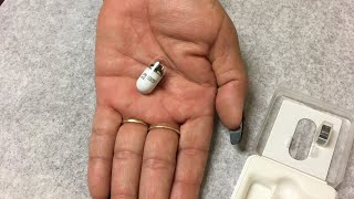 My experience with Capsule Endoscopy 112019 pillcam capsuleendoscopy [upl. by Sarah682]