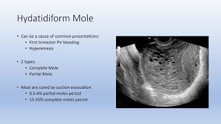 Gestational Trophoblastic Disease GTD [upl. by Islehc453]