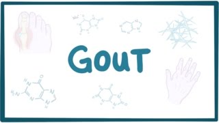 Gout  causes symptoms diagnosis treatment pathology [upl. by Shari591]