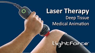 Laser Therapy  Deep Tissue Medical Animation [upl. by Alicul]