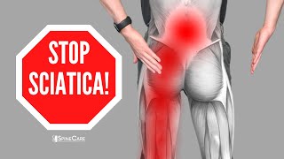 How to Relieve Sciatica Pain in SECONDS [upl. by Dej]