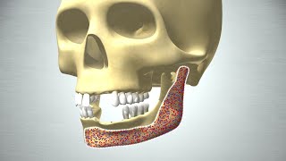 Revolution in Bone Regeneration [upl. by Telimay]