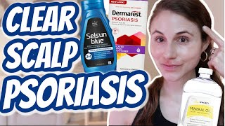 How to CLEAR SCALP PSORIASIS Dr Dray [upl. by Everett]