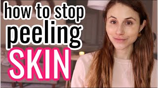 How to STOP PEELING SKIN Dr Dray [upl. by Trent232]