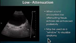 Bladder UltrasoundKUB [upl. by Edniya917]