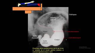 SERIE ESOFAGOGASTRODUODENAL ANATOMIA FUNCION Y REALIZACION [upl. by Raybin]