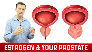 How To Fix Enlarged Prostate Explained By Dr Berg [upl. by Suoiluj]