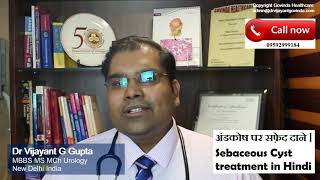 अंडकोष पर फोड़े फुंसी  अंडकोष के बालतोड़  Sebaceous Cyst Scrotum treatment in Hindi [upl. by Yolanda]