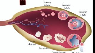 Ovarian Cysts [upl. by Nwavahs770]